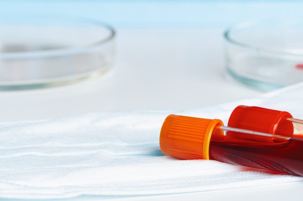 Close up of blood test tube with blood